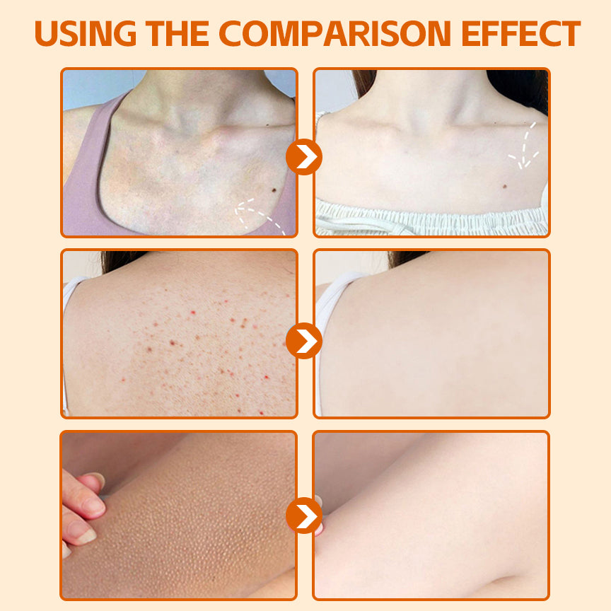 BIOAOUA Vitamin C Whitening Body Lotion Permanent Whitening Moisturizing Remove Melanin 300g