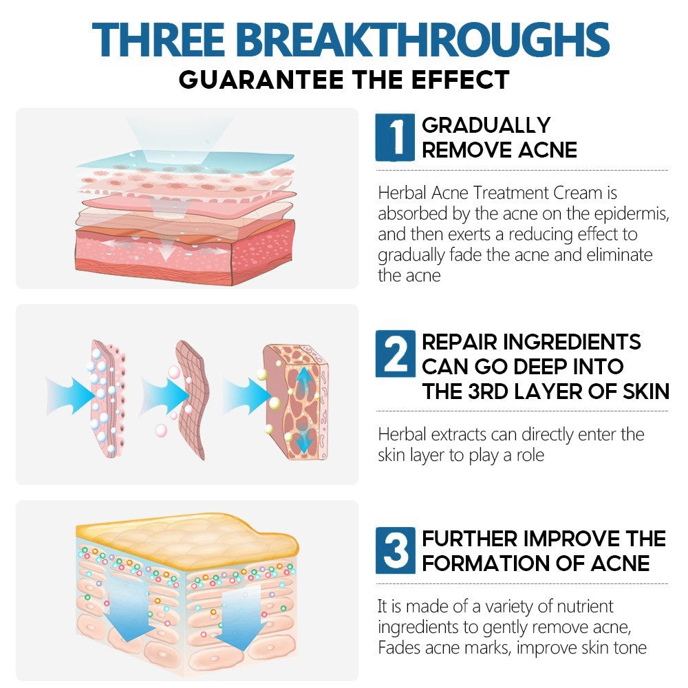 BIOAOUA Salicylic Acid Pore Refining Serum Moisturizing Acne Treatment Serum Skin Care 30ml