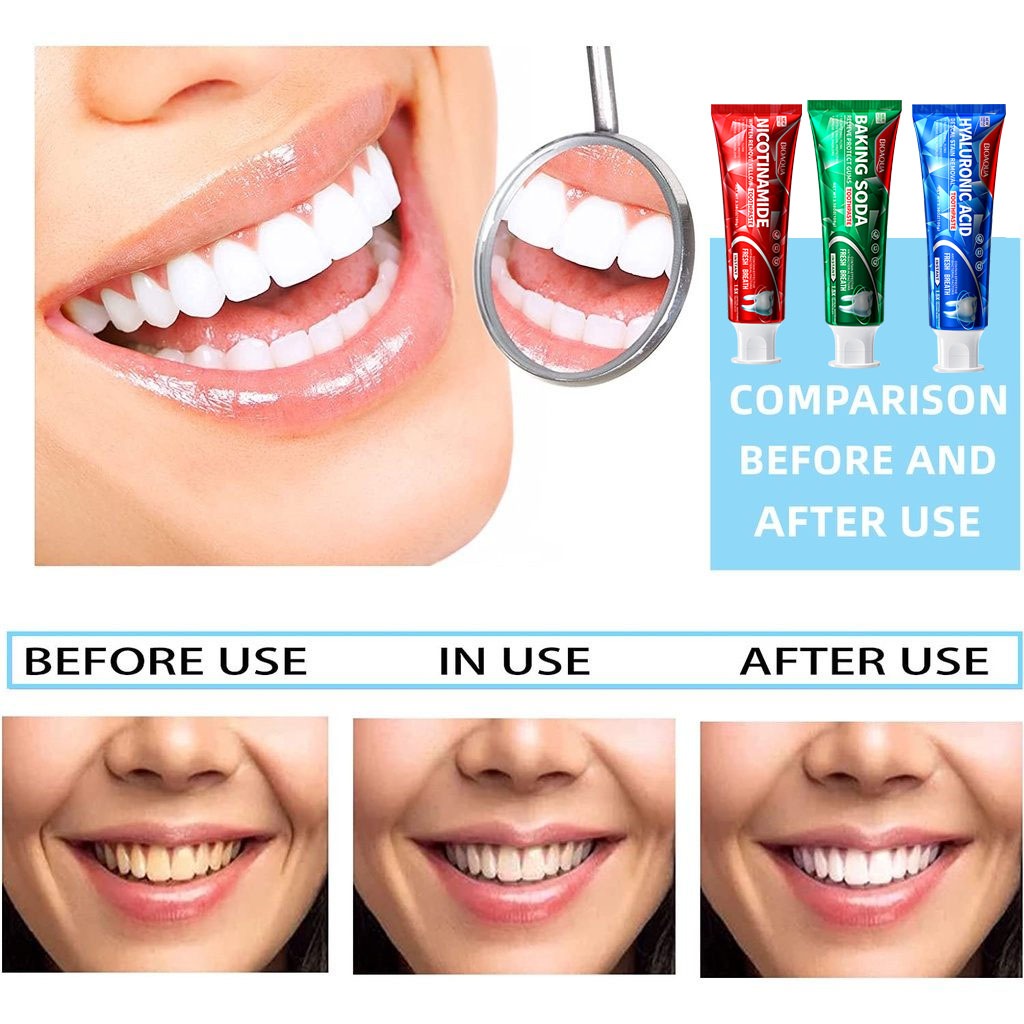 BIOAOUA Toothpaste  Baking soda  Nicotinamide  Whitening And Yellowing Removal Fresh oral cavity