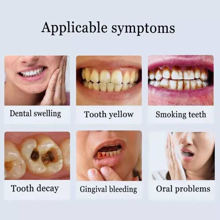 BIOAOUA Toothpaste  Baking soda  Nicotinamide  Whitening And Yellowing Removal Fresh oral cavity