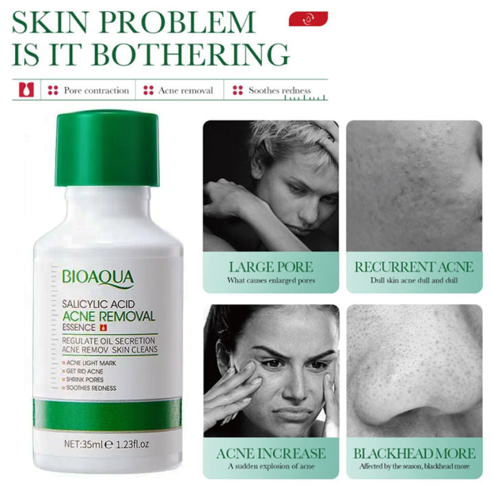 BIOAOUA Salicylic Acid Pore Refining Serum Moisturizing Acne Treatment Serum Skin Care 30ml