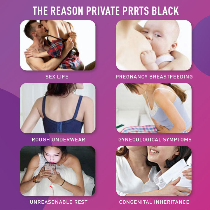 BIOAOUA Private Parts Whitening Body Cream Skin Lightening Pink Cherry Whitening Pinkish Cream 30g