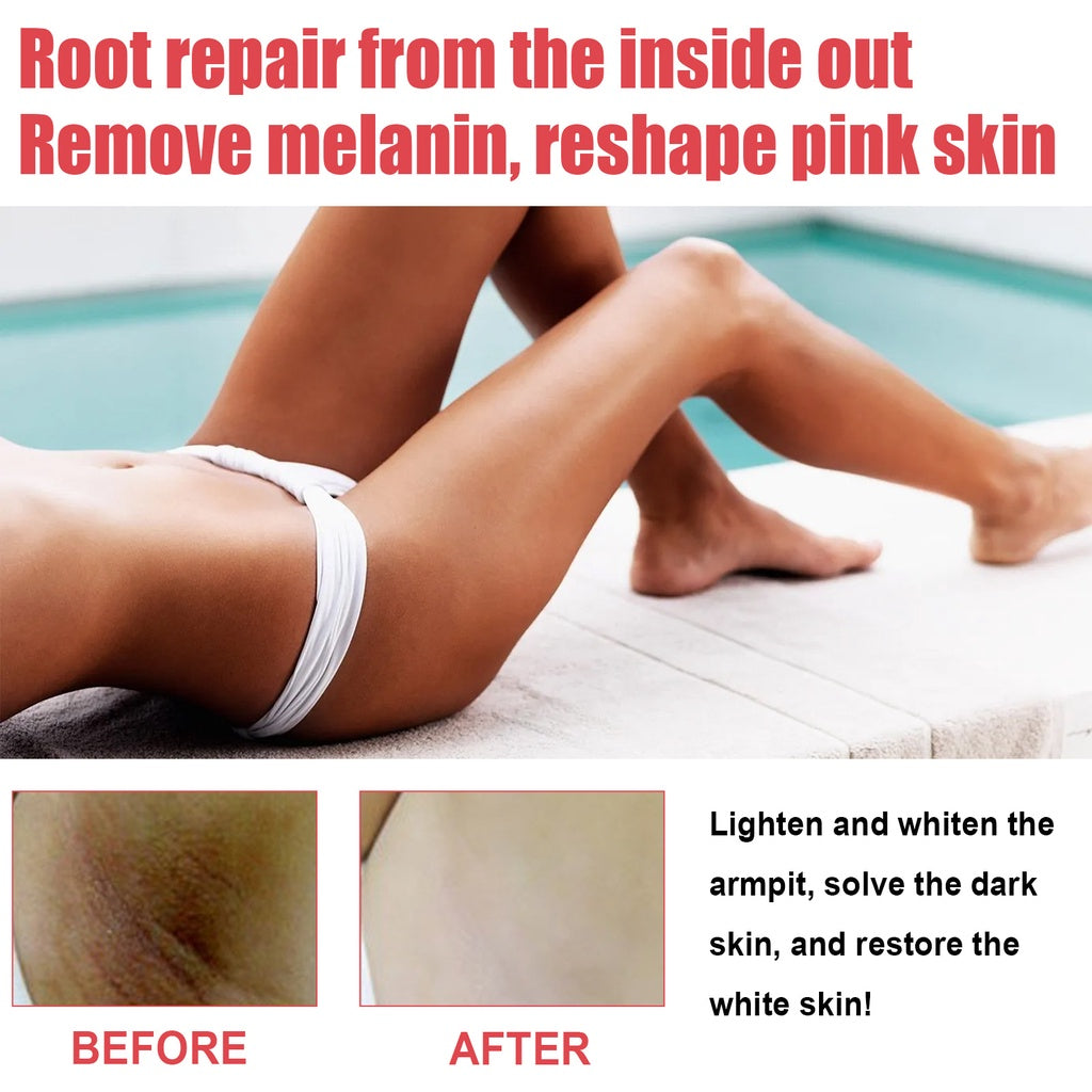 BIOAOUA Private Parts Whitening Body Cream Skin Lightening Pink Cherry Whitening Pinkish Cream 30g