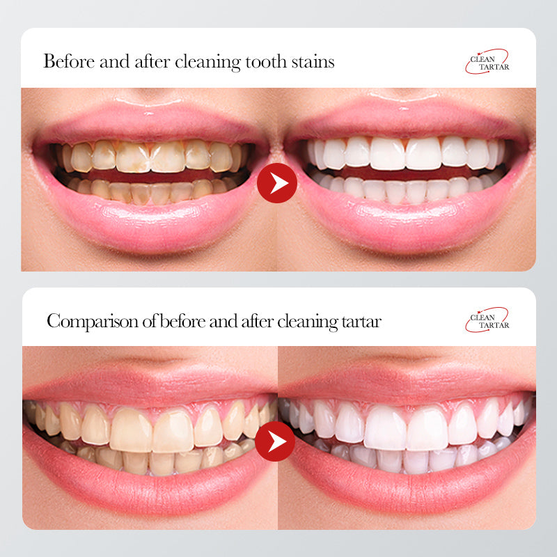 BIOAOUA Toothpaste  Baking soda  Nicotinamide  Whitening And Yellowing Removal Fresh oral cavity