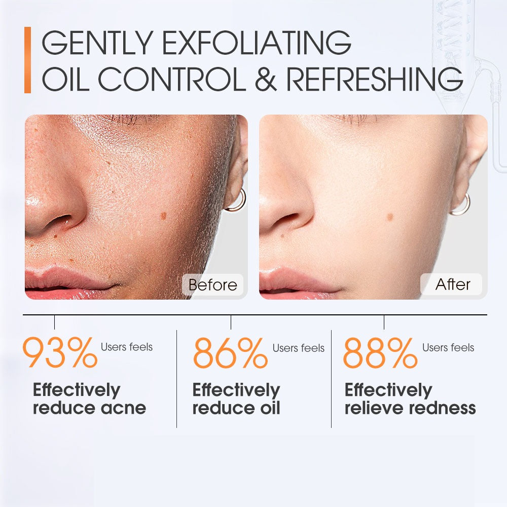 BIOAOUA Salicylic Acid Acne Removal Cleanser 100g